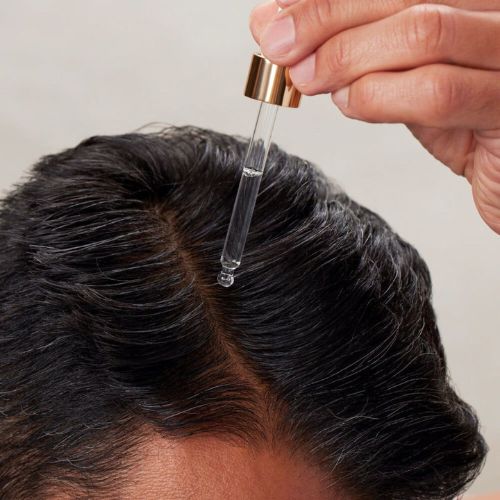 Mens Hair Loss Treatment