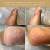 100% Oil-Based Antifungal Serum