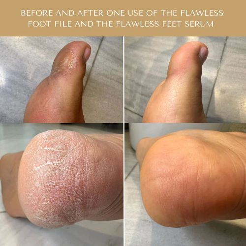 100% Oil-Based Antifungal Serum