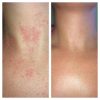 Tea Tree Oil + Lavender Oil + Black Seed Oil